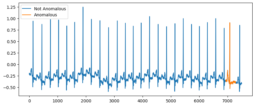 ../_images/examples_07_detection_anomaly_changepoints_20_1.png